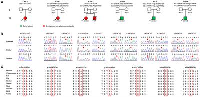 SZT2 variants associated with partial epilepsy or epileptic encephalopathy and the genotype-phenotype correlation